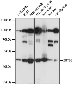 WB analysis of various sample lysates using GTX66336 ZBTB6 antibody. Dilution : 1:1000 Loading : 25microg per lane WB analysis of various sample lysates using GTX66336 ZBTB6 antibody. Dilution : 1:1000 Loading : 25microg per lane