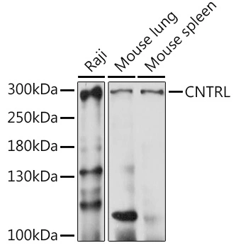 WB analysis of various sample lysates using GTX66337 CNTRL antibody. Dilution : 1:1000 Loading : 25microg per lane WB analysis of various sample lysates using GTX66337 CNTRL antibody. Dilution : 1:1000 Loading : 25microg per lane