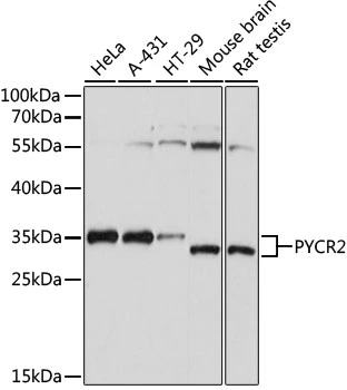 WB analysis of various sample lysates using GTX66340 PYCR2 antibody. Dilution : 1:1000 Loading : 25microg per lane
