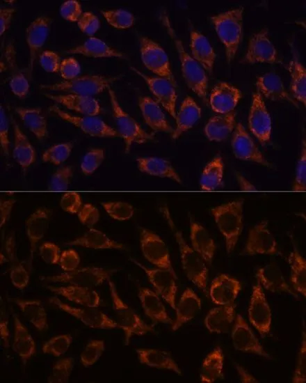 ICC/IF analysis of L929 cells using GTX66340 PYCR2 antibody. Blue : DAPI Dilution : 1:100