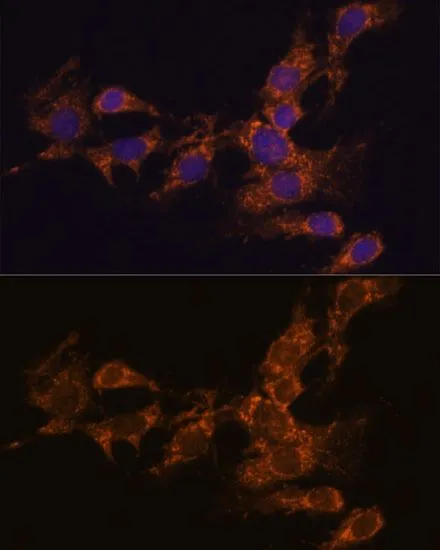 ICC/IF analysis of C6 cells using GTX66340 PYCR2 antibody. Blue : DAPI Dilution : 1:100