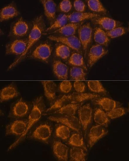 ICC/IF analysis of HeLa cells using GTX66340 PYCR2 antibody. Blue : DAPI Dilution : 1:100