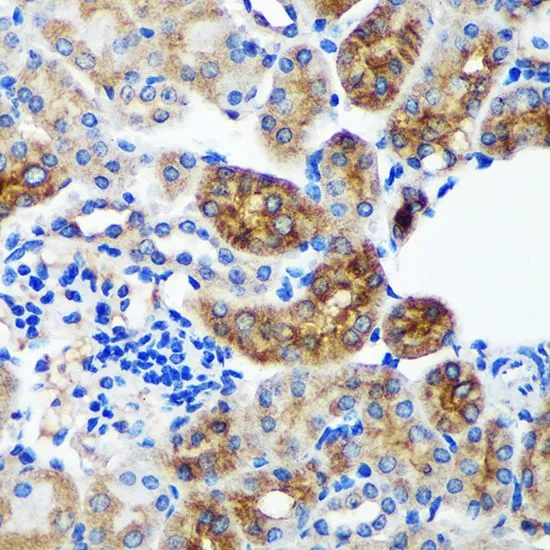 IHC-P analysis of mouse kidney tissue using GTX66340 PYCR2 antibody. Dilution : 1:100