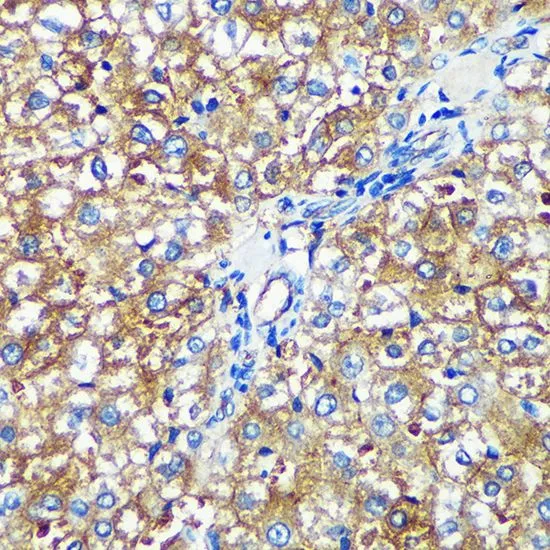IHC-P analysis of rat liver tissue using GTX66340 PYCR2 antibody. Dilution : 1:100