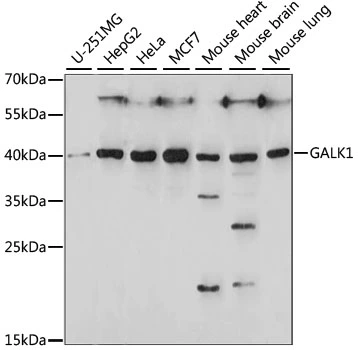 WB analysis of various sample lysates using GTX66350 GALK1 antibody. Dilution : 1:1000 Loading : 25microg per lane WB analysis of various sample lysates using GTX66350 GALK1 antibody. Dilution : 1:1000 Loading : 25microg per lane