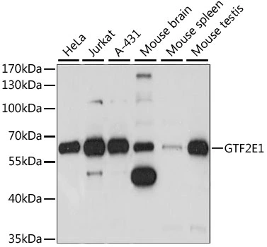 WB analysis of various sample lysates using GTX66351 GTF2E1 antibody. Dilution : 1:1000 Loading : 25microg per lane WB analysis of various sample lysates using GTX66351 GTF2E1 antibody. Dilution : 1:1000 Loading : 25microg per lane