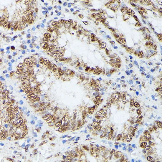 IHC-P analysis of human colon tissue using GTX66353 KIF22 antibody. Dilution : 1:100