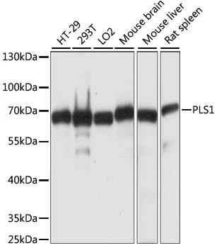 WB analysis of various sample lysates using GTX66355 PLS1 antibody. Dilution : 1:1000 Loading : 25microg per lane WB analysis of various sample lysates using GTX66355 PLS1 antibody. Dilution : 1:1000 Loading : 25microg per lane
