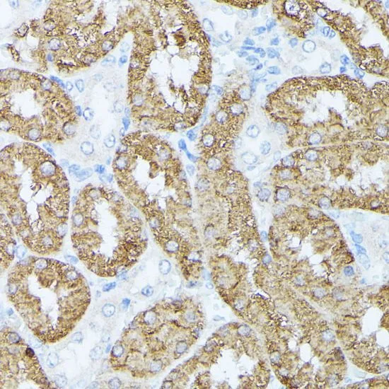IHC-P analysis of rat kidney tissue using GTX66355 PLS1 antibody. Dilution : 1:100