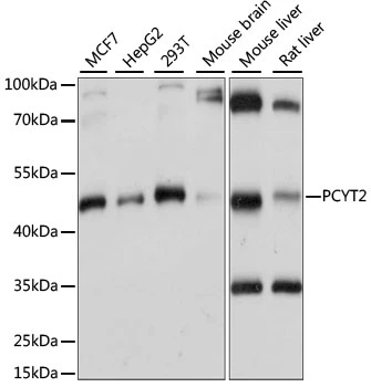 WB analysis of various sample lysates using GTX66356 PCYT2 antibody. Dilution : 1:1000 Loading : 25microg per lane WB analysis of various sample lysates using GTX66356 PCYT2 antibody. Dilution : 1:1000 Loading : 25microg per lane