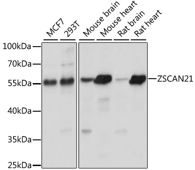 WB analysis of various sample lysates using GTX66359 ZNF38 antibody. Dilution : 1:1000 Loading : 25microg per lane WB analysis of various sample lysates using GTX66359 ZNF38 antibody. Dilution : 1:1000 Loading : 25microg per lane