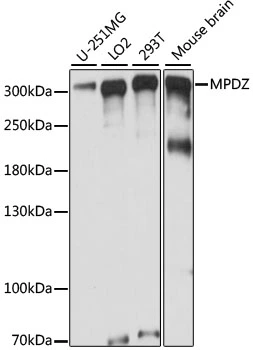 WB analysis of various sample lysates using GTX66360 MPDZ antibody. Dilution : 1:1000 Loading : 25microg per lane WB analysis of various sample lysates using GTX66360 MPDZ antibody. Dilution : 1:1000 Loading : 25microg per lane