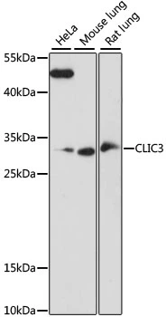 WB analysis of various sample lysates using GTX66361 CLIC3 antibody. Dilution : 1:1000 Loading : 25microg per lane