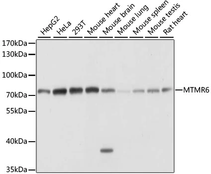 WB analysis of various sample lysates using GTX66362 MTMR6 antibody. Dilution : 1:1000 Loading : 25microg per lane WB analysis of various sample lysates using GTX66362 MTMR6 antibody. Dilution : 1:1000 Loading : 25microg per lane