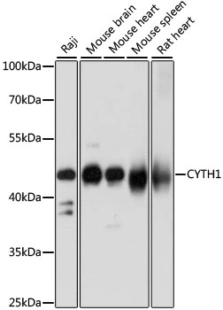 WB analysis of various sample lysates using GTX66363 Cytohesin 1 antibody. Dilution : 1:1000 Loading : 25microg per lane WB analysis of various sample lysates using GTX66363 Cytohesin 1 antibody. Dilution : 1:1000 Loading : 25microg per lane