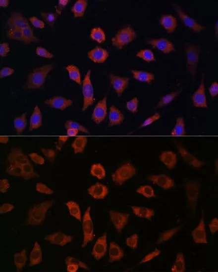 ICC/IF analysis of L929 cells using GTX66363 Cytohesin 1 antibody. Blue : DAPI Dilution : 1:100