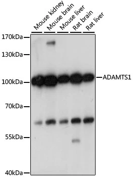 WB analysis of various sample lysates using GTX66366 ADAMTS1 antibody. Dilution : 1:1000 Loading : 25microg per lane WB analysis of various sample lysates using GTX66366 ADAMTS1 antibody. Dilution : 1:1000 Loading : 25microg per lane