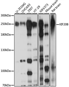 WB analysis of various sample lysates using GTX66368 KIF20B antibody. Dilution : 1:1000 Loading : 25microg per lane WB analysis of various sample lysates using GTX66368 KIF20B antibody. Dilution : 1:1000 Loading : 25microg per lane