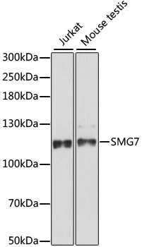 WB analysis of various sample lysates using GTX66369 SMG7 antibody. Dilution : 1:1000 Loading : 25microg per lane WB analysis of various sample lysates using GTX66369 SMG7 antibody. Dilution : 1:1000 Loading : 25microg per lane