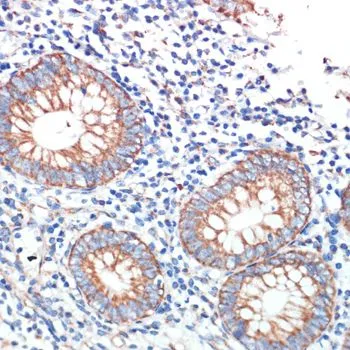 IHC-P analysis of human appendix tissue using GTX66373 AFG3L2 antibody. Dilution : 1:200