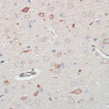 IHC-P analysis of rat brain tissue using GTX66373 AFG3L2 antibody. Dilution : 1:200