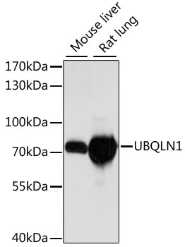 WB analysis of various sample lysates using GTX66380 Ubiquilin 1 antibody. Dilution : 1:1000 Loading : 25microg per lane WB analysis of various sample lysates using GTX66380 Ubiquilin 1 antibody. Dilution : 1:1000 Loading : 25microg per lane