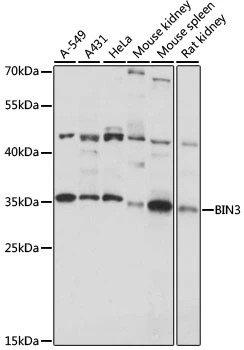 WB analysis of various sample lysates using GTX66384 BIN3 antibody. Dilution : 1:1000 Loading : 25microg per lane WB analysis of various sample lysates using GTX66384 BIN3 antibody. Dilution : 1:1000 Loading : 25microg per lane