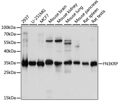 WB analysis of various sample lysates using GTX66387 FN3KRP antibody. Dilution : 1:1000 Loading : 25microg per lane WB analysis of various sample lysates using GTX66387 FN3KRP antibody. Dilution : 1:1000 Loading : 25microg per lane