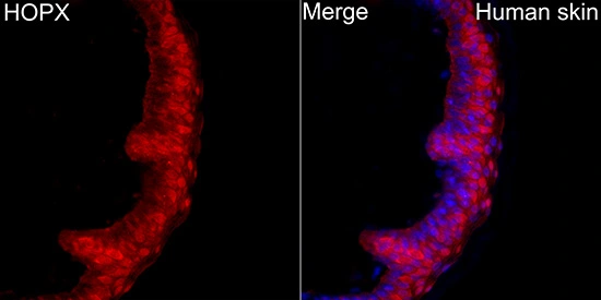 IHC-P analysis of human skin tissue using GTX66394 HOPX antibody. Orange : Primary antibody Blue : DAPI Antigen retrieval : high pressure antigen retrieval with 0.01 M citrate buffer (pH 6.0) Dilution : 1:200 IHC-P analysis of human skin tissue using GTX66394 HOPX antibody. Orange : Primary antibody Blue : DAPI Antigen retrieval : high pressure antigen retrieval with 0.01 M citrate buffer (pH 6.0) Dilution : 1:200