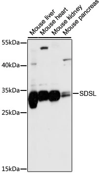 WB analysis of various sample lysates using GTX66395 SDSL antibody. Dilution : 1:1000 Loading : 25microg per lane WB analysis of various sample lysates using GTX66395 SDSL antibody. Dilution : 1:1000 Loading : 25microg per lane