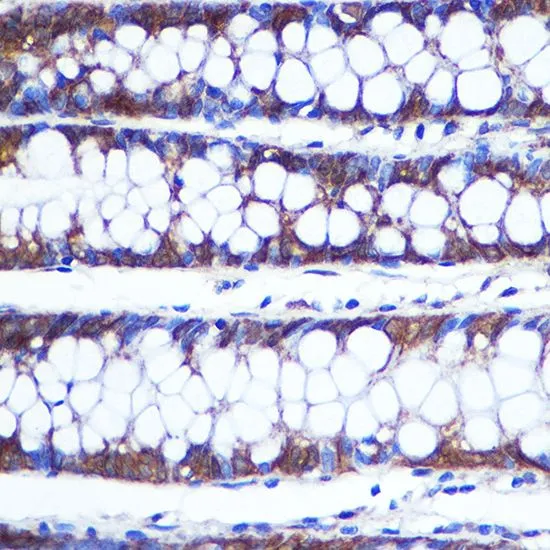 IHC-P analysis of human colon tissue using GTX66397 TOP1MT antibody. Dilution : 1:100