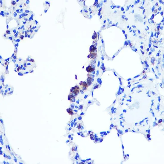 IHC-P analysis of rat lung tissue using GTX66397 TOP1MT antibody. Dilution : 1:100