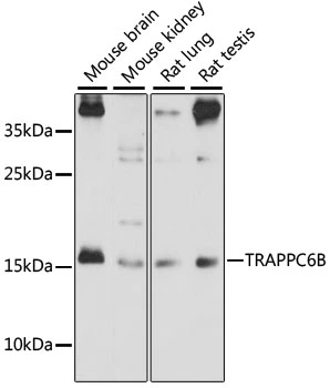 WB analysis of various sample lysates using GTX66398 TRAPPC6B antibody. Dilution : 1:1000 Loading : 25microg per lane WB analysis of various sample lysates using GTX66398 TRAPPC6B antibody. Dilution : 1:1000 Loading : 25microg per lane