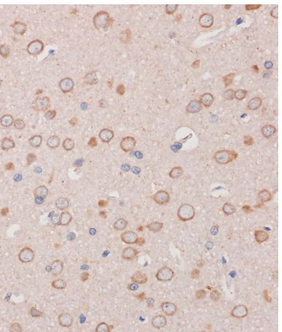 IHC-P analysis of rat brain tissue using GTX66398 TRAPPC6B antibody. Dilution : 1:100