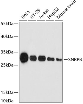 WB analysis of extracts of various cell lines using GTX66411 SNRPB antibody. The signal was developed with ECL plus-Enhanced. Loading : 25ug per lane Dilution : 1:3000