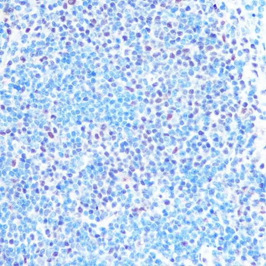 IHC-P analysis of mouse spleen tissue using GTX66411 SNRPB antibody. Dilution : 1:100
