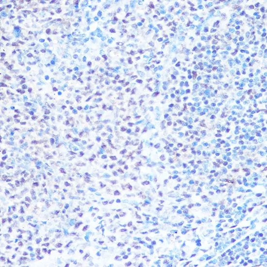 IHC-P analysis of rat spleen tissue using GTX66411 SNRPB antibody. Dilution : 1:100