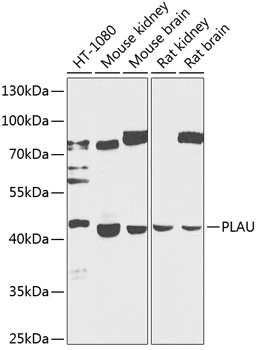 WB analysis of various sample lysates using GTX66413 Urokinase antibody. Dilution : 1:1000 Loading : 25microg per lane WB analysis of various sample lysates using GTX66413 Urokinase antibody. Dilution : 1:1000 Loading : 25microg per lane