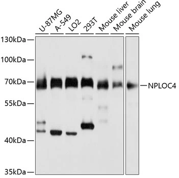 WB analysis of various sample lysates using GTX66423 NPL4 antibody. Dilution : 1:3000 Loading : 25microg per lane WB analysis of various sample lysates using GTX66423 NPL4 antibody. Dilution : 1:3000 Loading : 25microg per lane