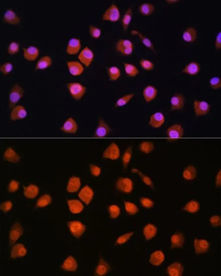 ICC/IF analysis of L929 cells using GTX66423 NPL4 antibody. Blue : DAPI Dilution : 1:100