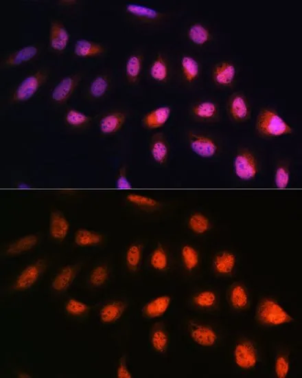 ICC/IF analysis of U2OS cells using GTX66423 NPL4 antibody. Blue : DAPI Dilution : 1:100
