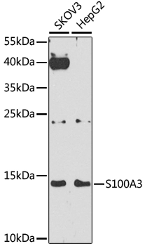 WB analysis of various sample lysates using GTX66434 S100A3 antibody. Dilution : 1:1000 Loading : 25microg per lane WB analysis of various sample lysates using GTX66434 S100A3 antibody. Dilution : 1:1000 Loading : 25microg per lane