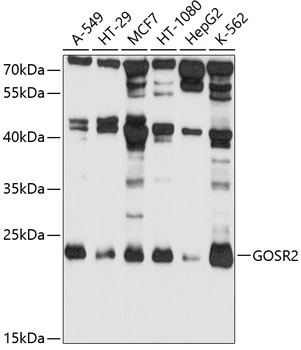 WB analysis of various sample lysates using GTX66440 Membrin antibody. Dilution : 1:1000 Loading : 25microg per lane WB analysis of various sample lysates using GTX66440 Membrin antibody. Dilution : 1:1000 Loading : 25microg per lane