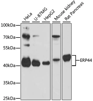 WB analysis of various sample lysates using GTX66444 TXNDC4 antibody. Dilution : 1:3000 Loading : 25microg per lane WB analysis of various sample lysates using GTX66444 TXNDC4 antibody. Dilution : 1:3000 Loading : 25microg per lane