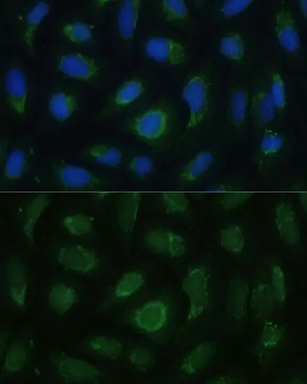 ICC/IF analysis of U2OS cells using GTX66449 SIGLEC9 antibody. Blue : DAPI Dilution : 1:100