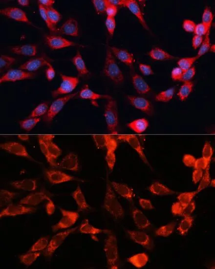 ICC/IF analysis of NIH/3T3 cells using GTX66451 MRPS28 antibody. Blue : DAPI Dilution : 1:100