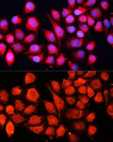 ICC/IF analysis of HeLa cells using GTX66451 MRPS28 antibody. Blue : DAPI Dilution : 1:100