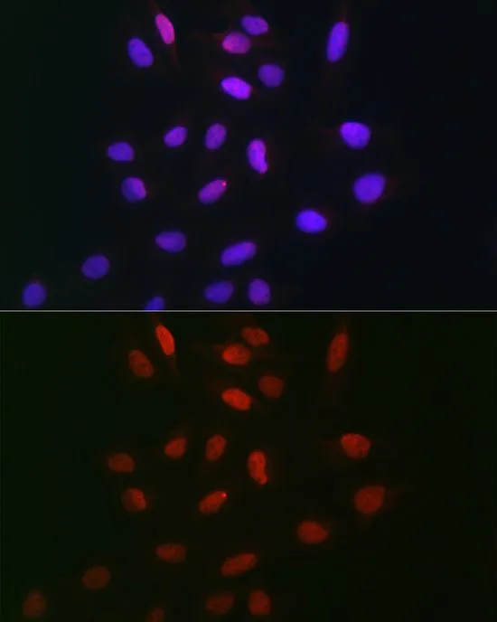 ICC/IF analysis of U2OS cells using GTX66457 TDP1 antibody. Blue : DAPI Dilution : 1:100
