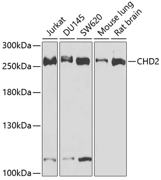 WB analysis of various sample lysates using GTX66469 CHD2 antibody. Dilution : 1:1000 Loading : 25microg per lane WB analysis of various sample lysates using GTX66469 CHD2 antibody. Dilution : 1:1000 Loading : 25microg per lane