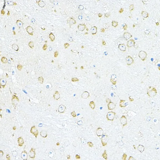 IHC-P analysis of mouse brain tissue using GTX66471 RPL10A antibody. Dilution : 1:100